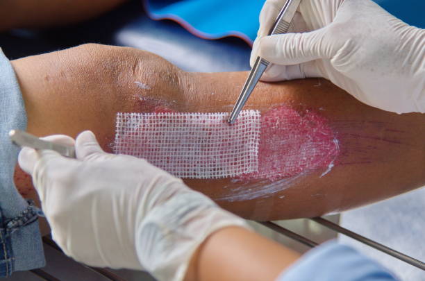 Close-up of professional wound care treatment on a patient